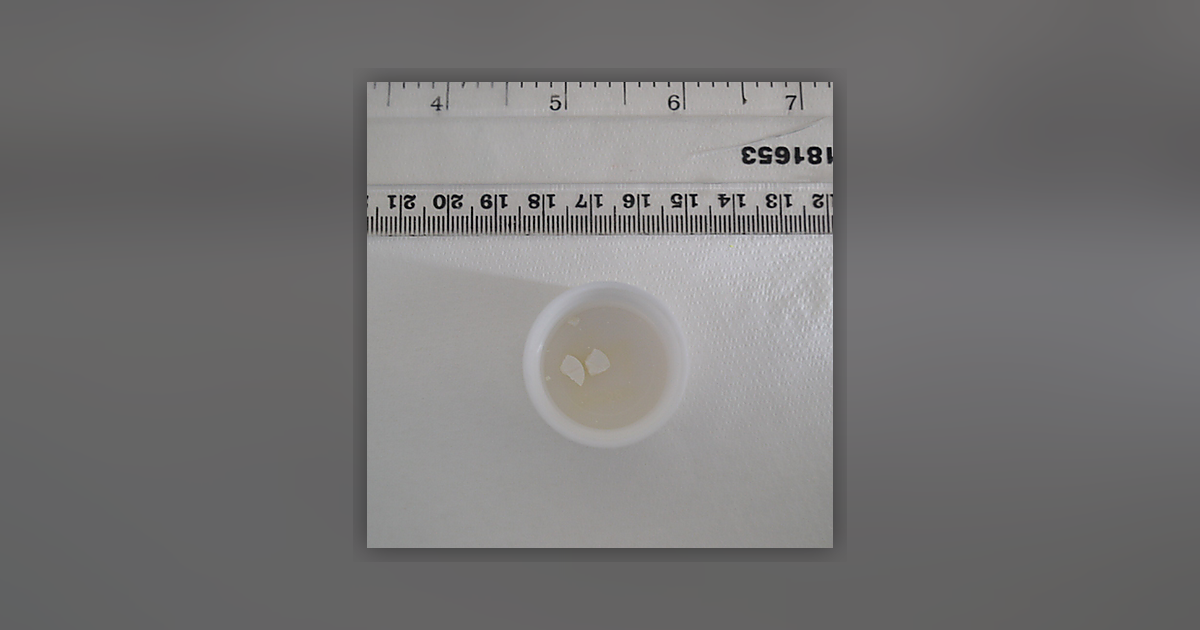 Nitrazepam