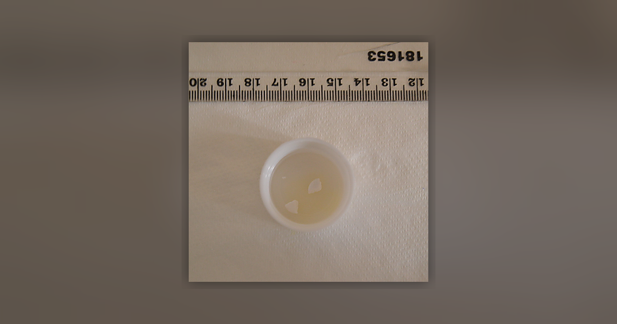 Bromazolam