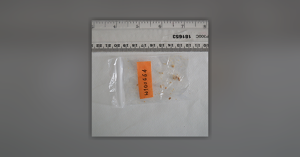 5-MeO-MiPT