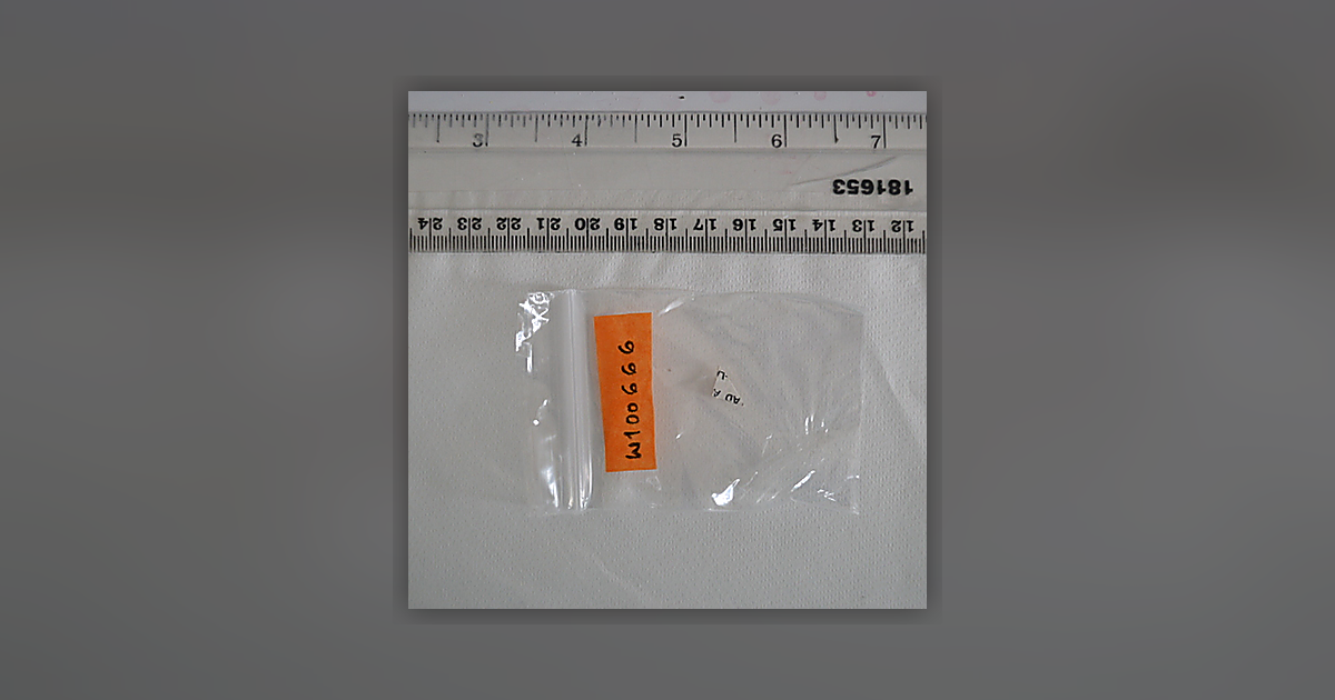 Unable to Identify (Insufficient sample for repeat analysis)