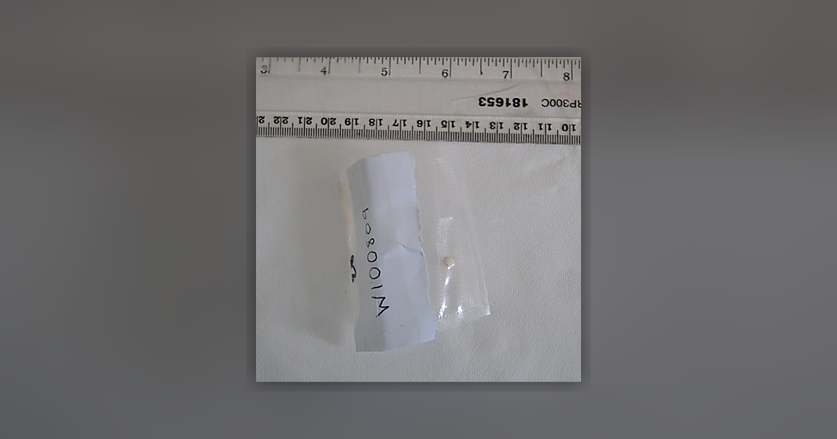 Oxycontin