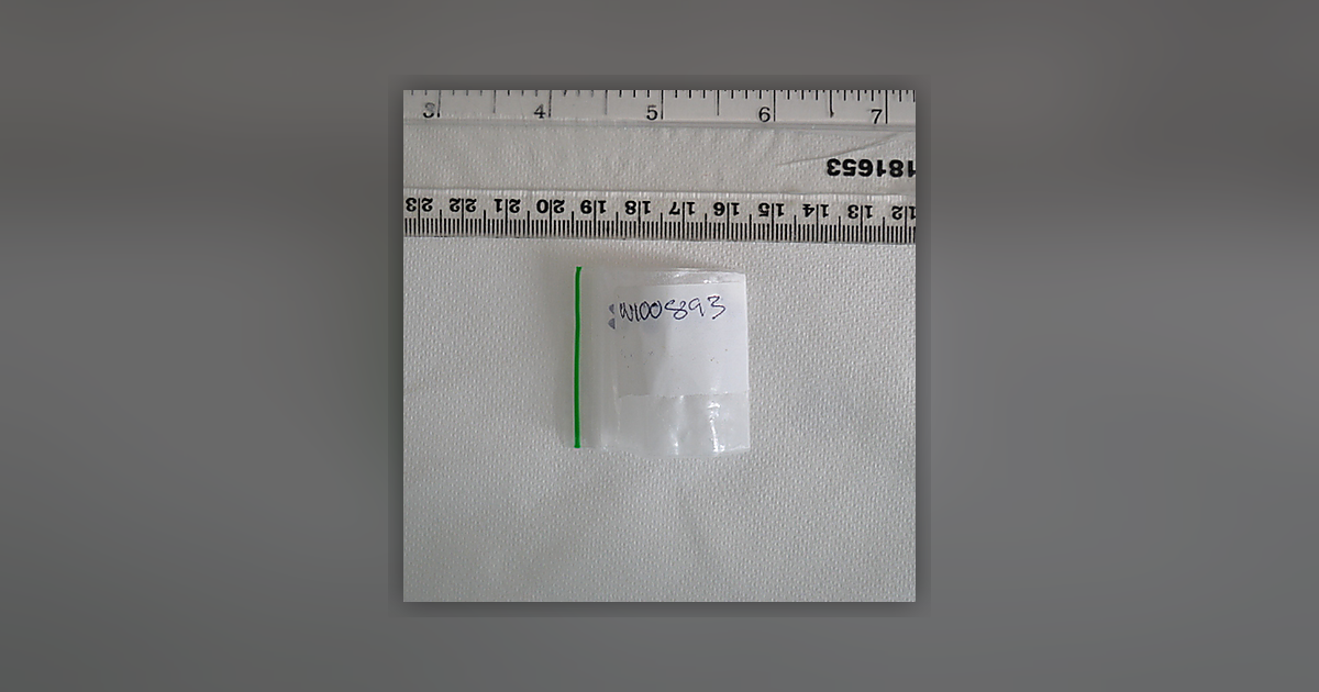 Ketamine; Benzocaine