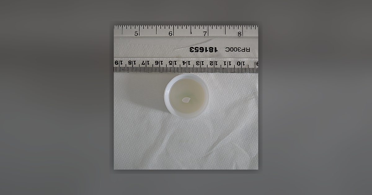 Diazepam