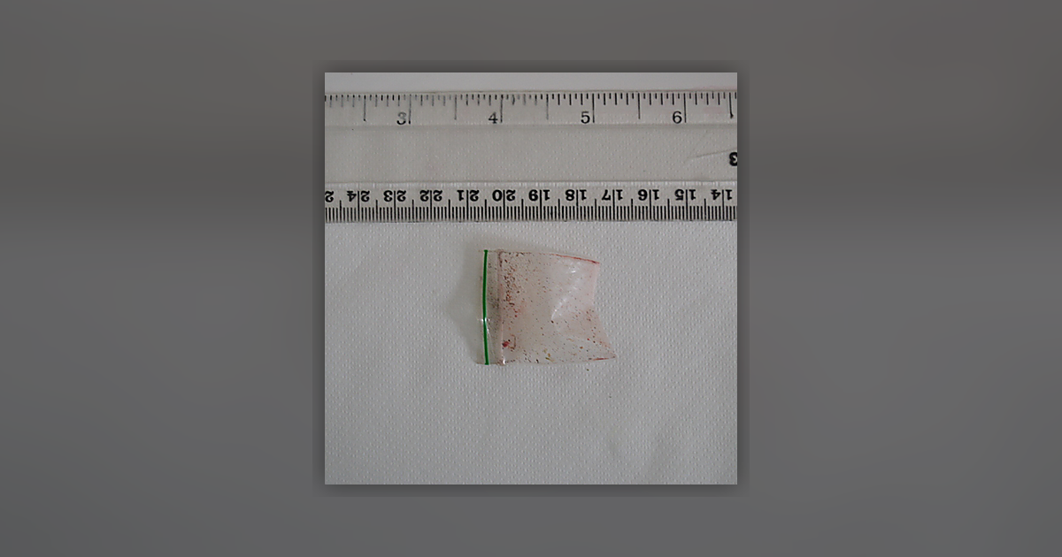 Ketamine; MDMA