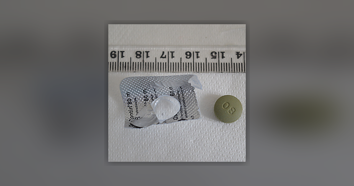 Oxycontin