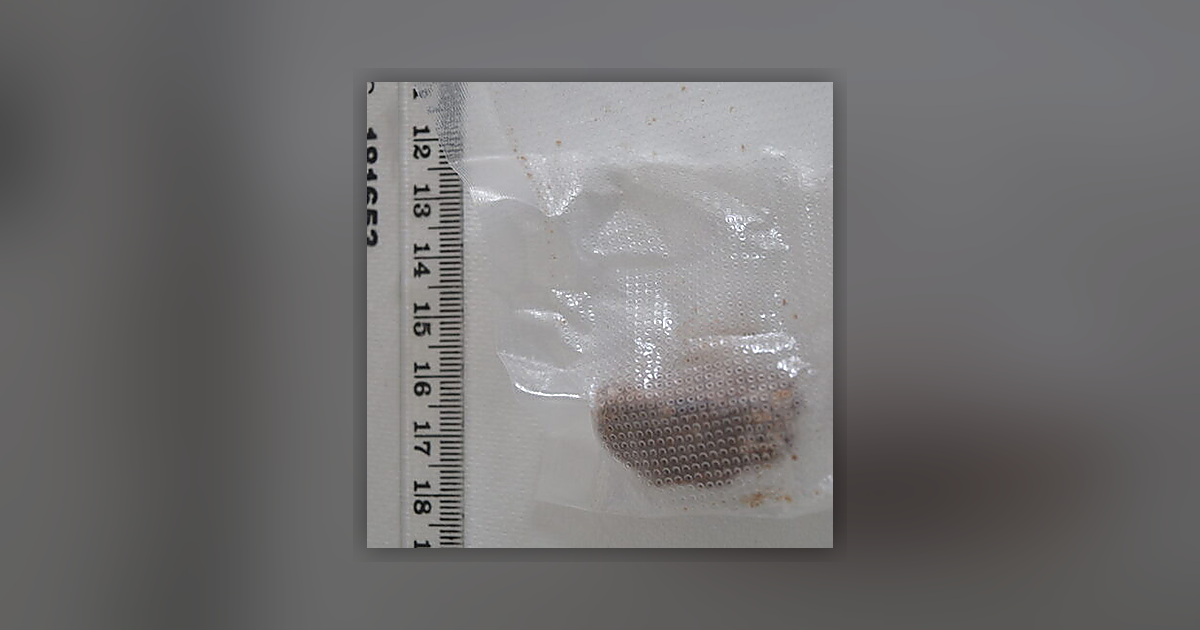 Caffeine; Theobromine