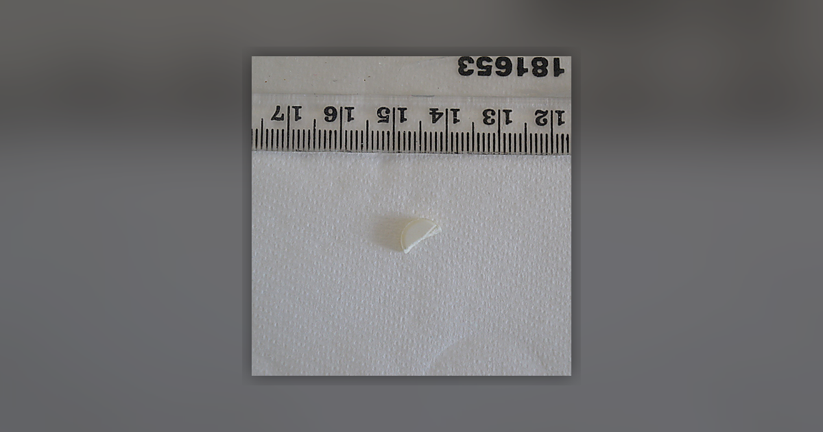 Oxymetholone