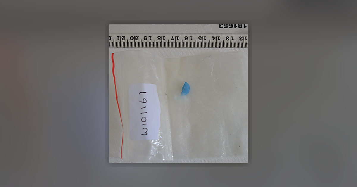 Zopiclone
