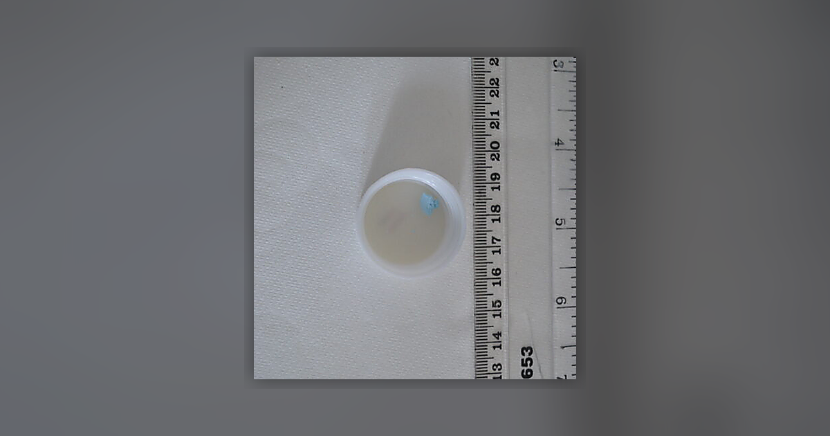 Diazepam