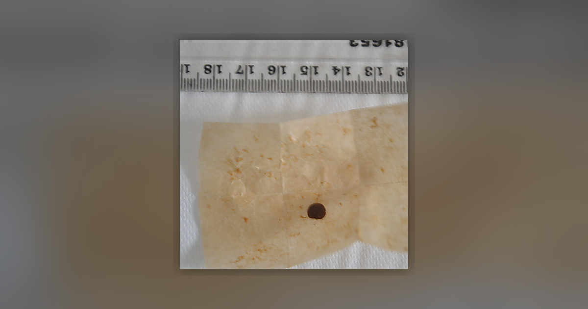 Morphine; Noscapine; Thebaine