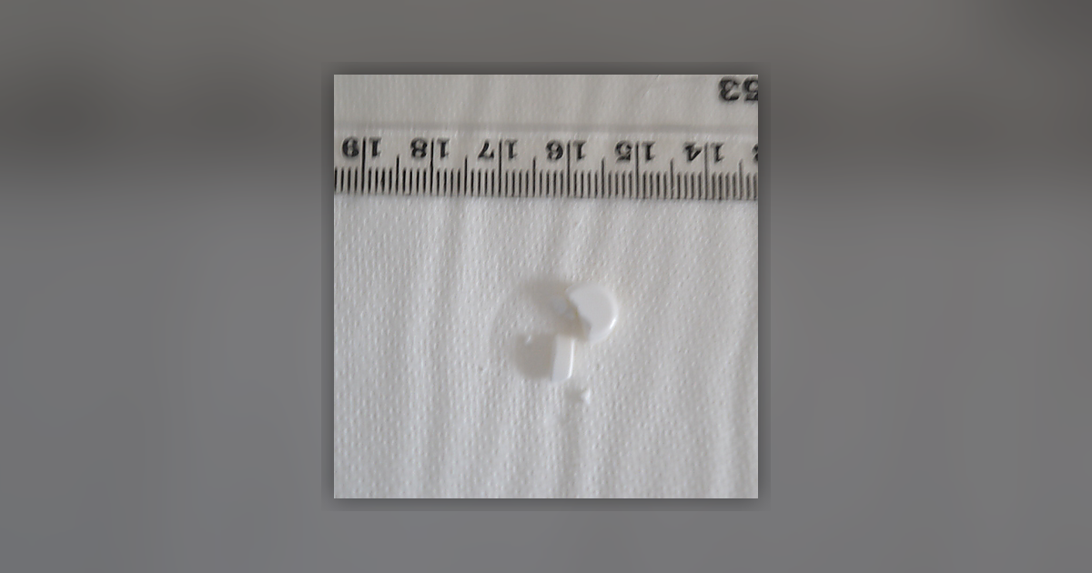 Dihydrocodeine
