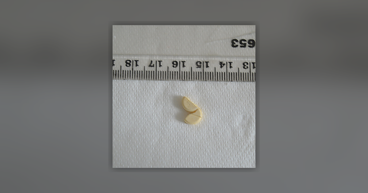 Diazepam