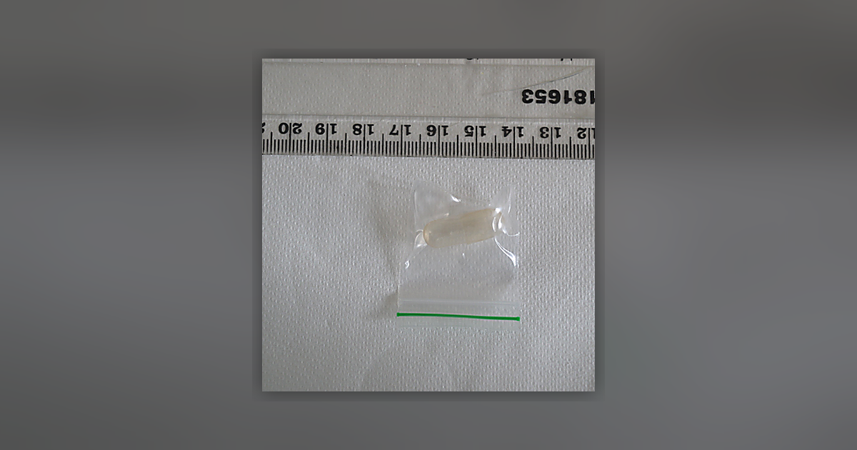 Ketamine
