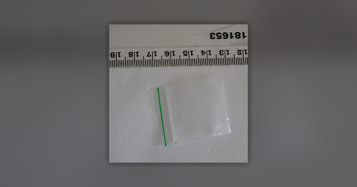 Ketamine; Paracetamol