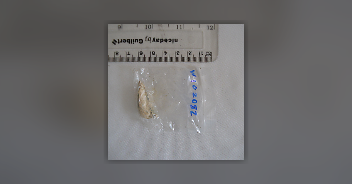 Psilocin