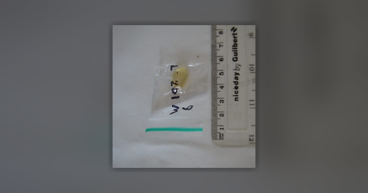 Temazepam