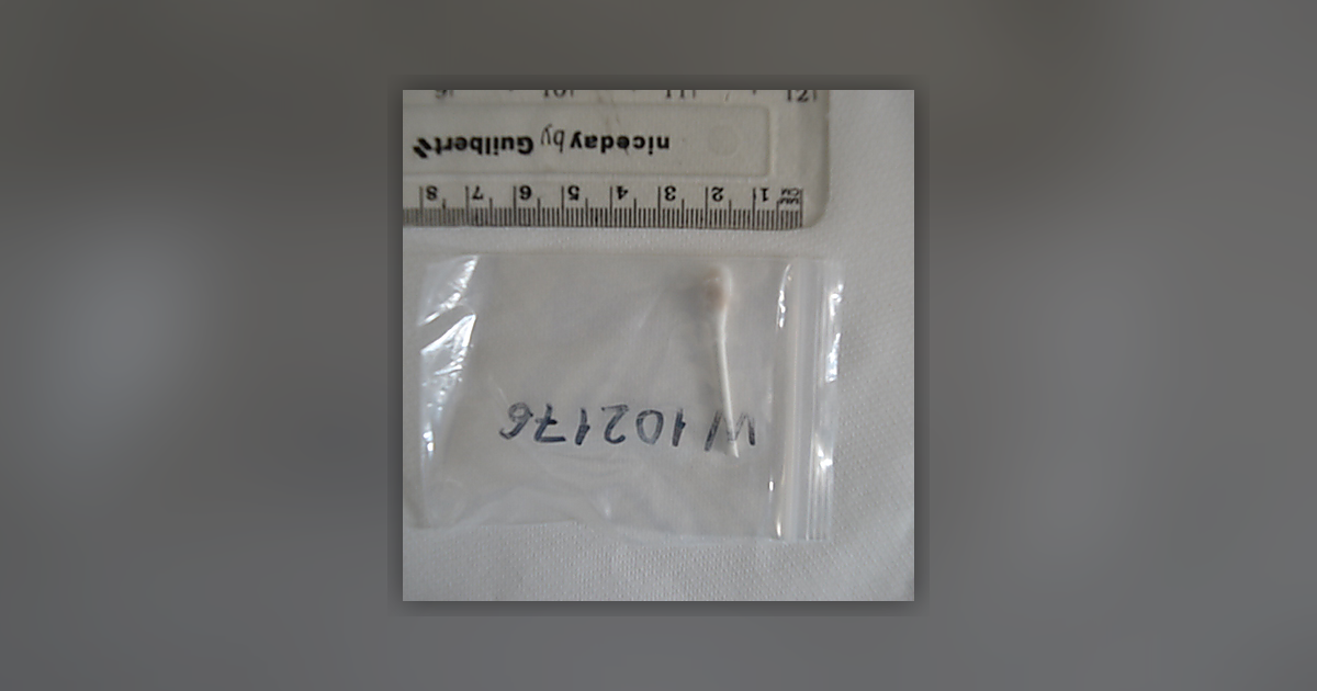 LSD