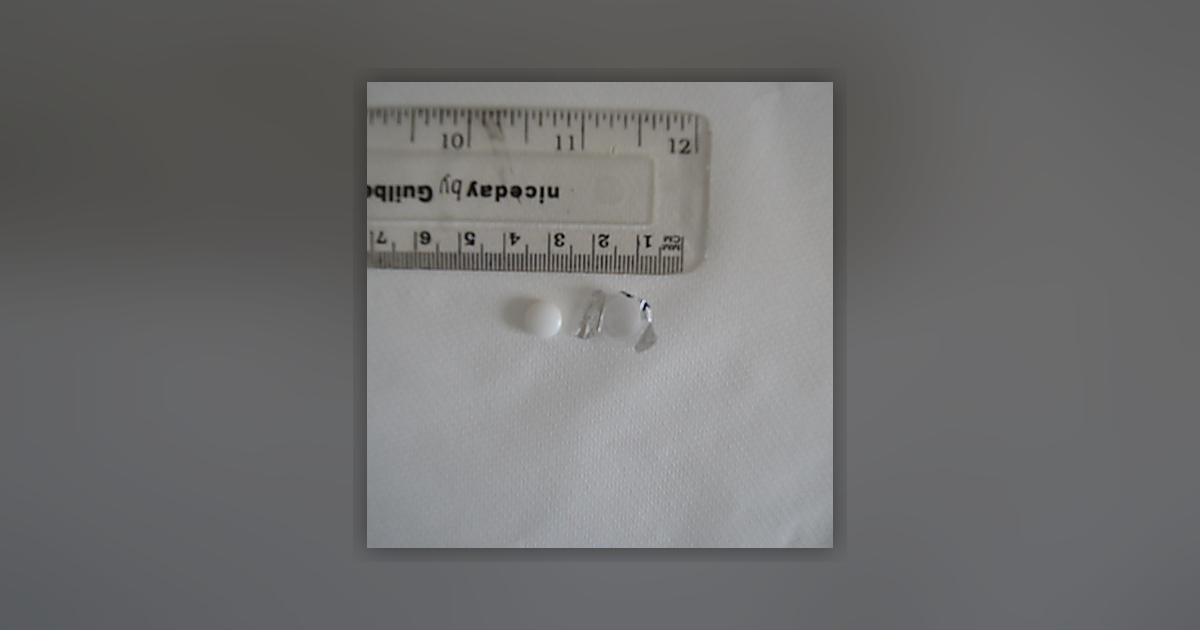 Diazepam