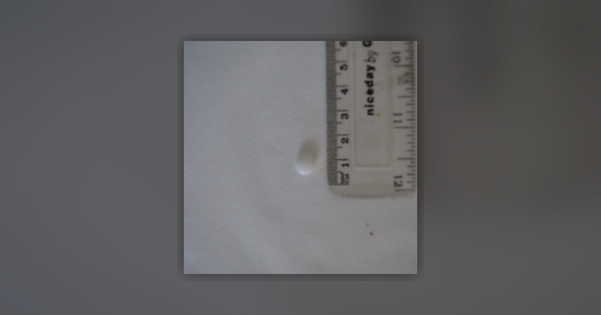 Diazepam