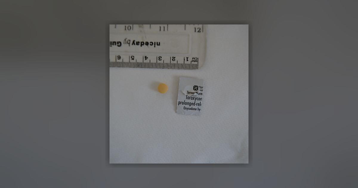 Toroxycon Prolonged Release Oxycodone HCL