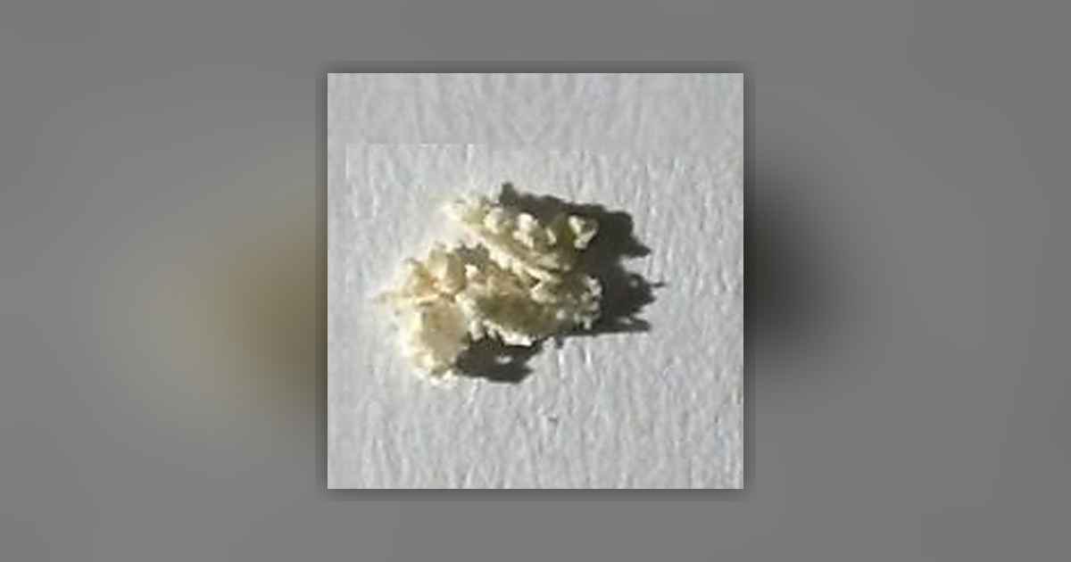 Amphetamine (83%)