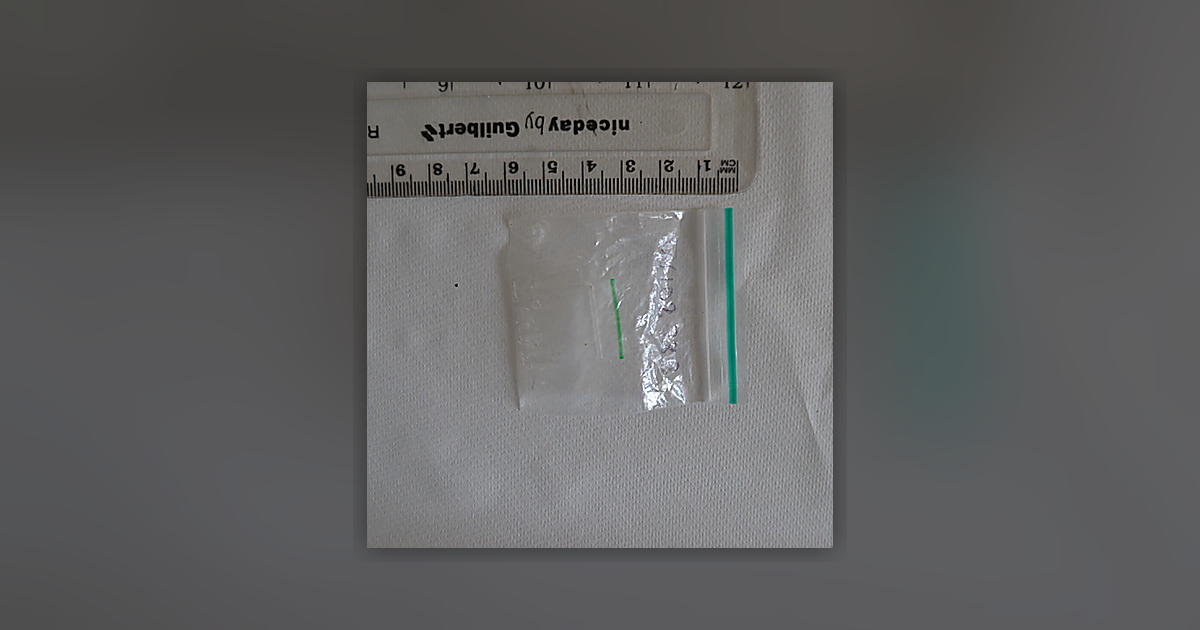 Ketamine
