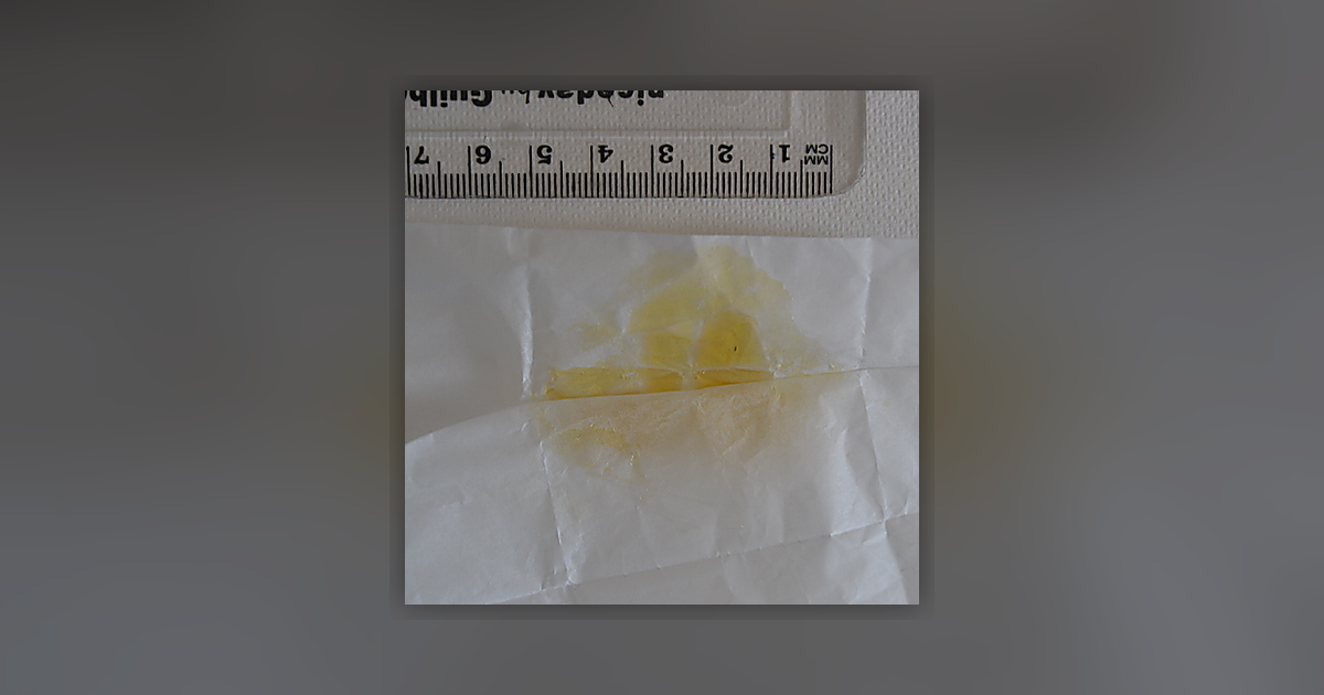 CBD; CBG; CBN; THC
