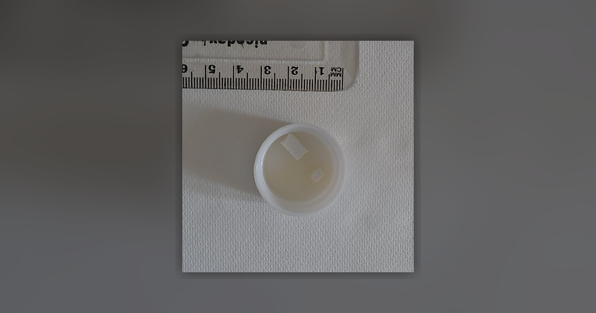 Xanax