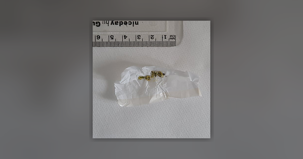 CBD; CBG; THC