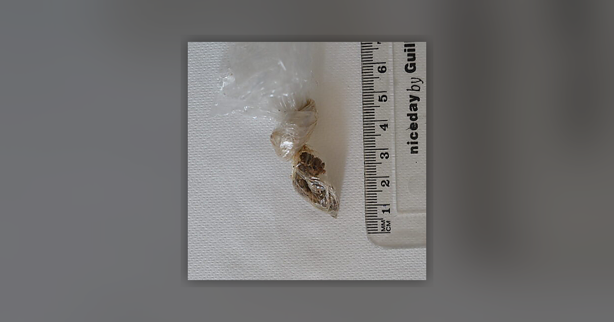 CBG; CBN; THC