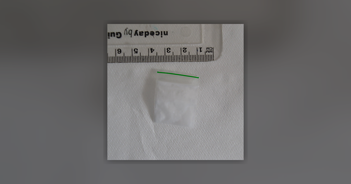 Ketamine
