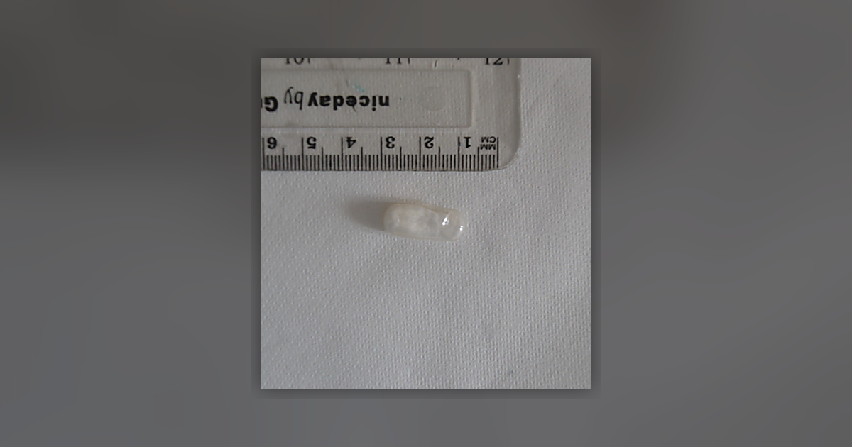 Venogen Phenibut