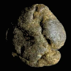 Brown Mojo Jojo pill — CBD; MDMB-4en-PINACA; THC — Basel, Switzerland