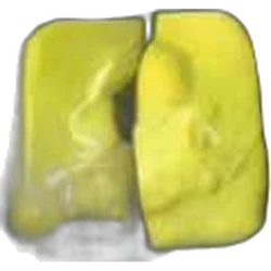 Yellow Snapchat ecstasy pill (XTC) — Caffeine; N-Ciclohexil Butilona — Baleares, Spain