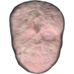 Pink Skull ecstasy pill (XTC) — MDMA 128mg — Huesca, Spain