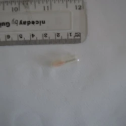 White Galenika Rivotril pill — Unable to Identify Insufficient sample for repeat analysis — Hackney, Tower Hamlets (E9), England