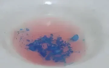 Scott test false positive result