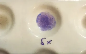 Morris reagent reactions with ketamine