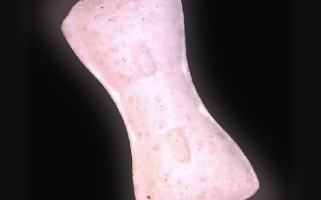 Gleich Wie Vorderseite pills (Ecstasy / MDMA)