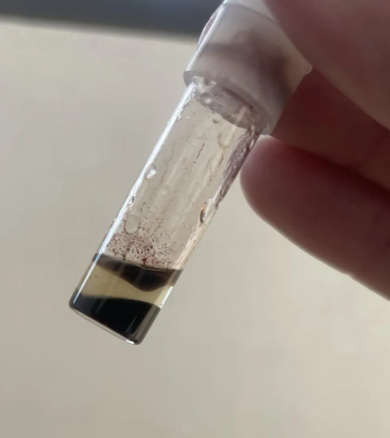 A cocaine purity ampoule held up to the light, its liquid split into a dark bottom layer, a clear middle layer and a dark top layer